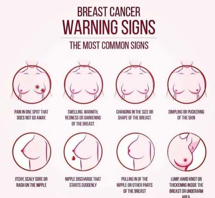 Early Signs of Breast Cancer