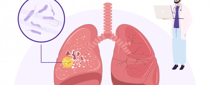 Understanding Tuberculosis Testing: the Quantiferon-TB Gold Test