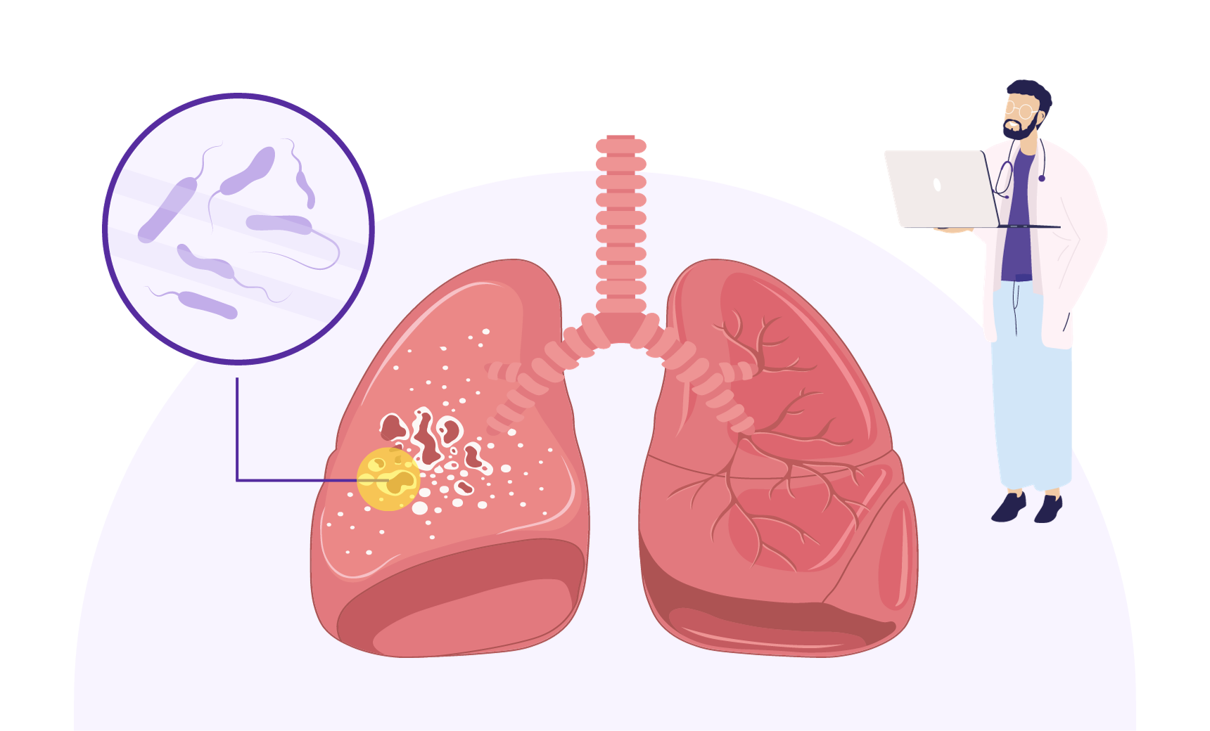 Understanding Tuberculosis Testing: the Quantiferon-TB Gold Test